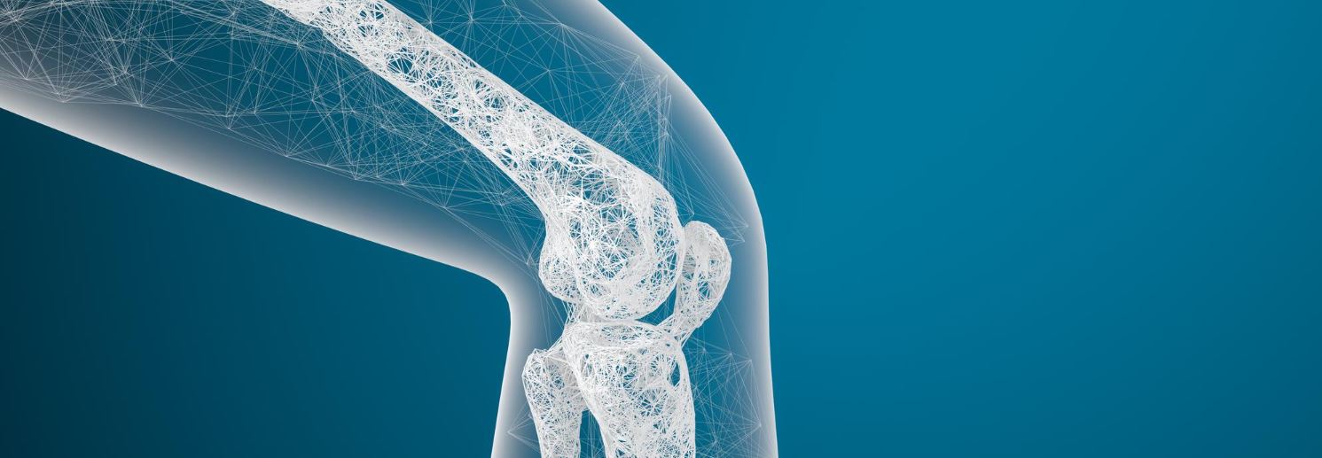 osteoporose een erfelijke aandoening